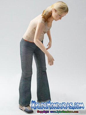 La Fiebre Chikungunya en Honduras